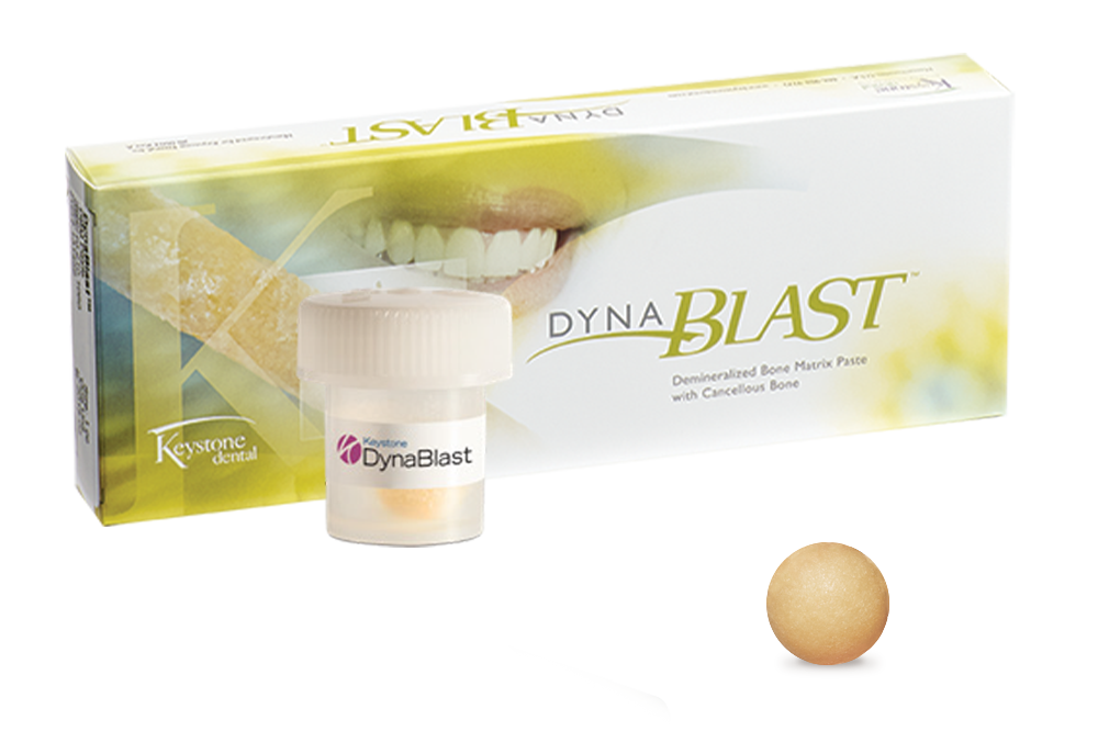 DynaBlast Putty 1cc Vial