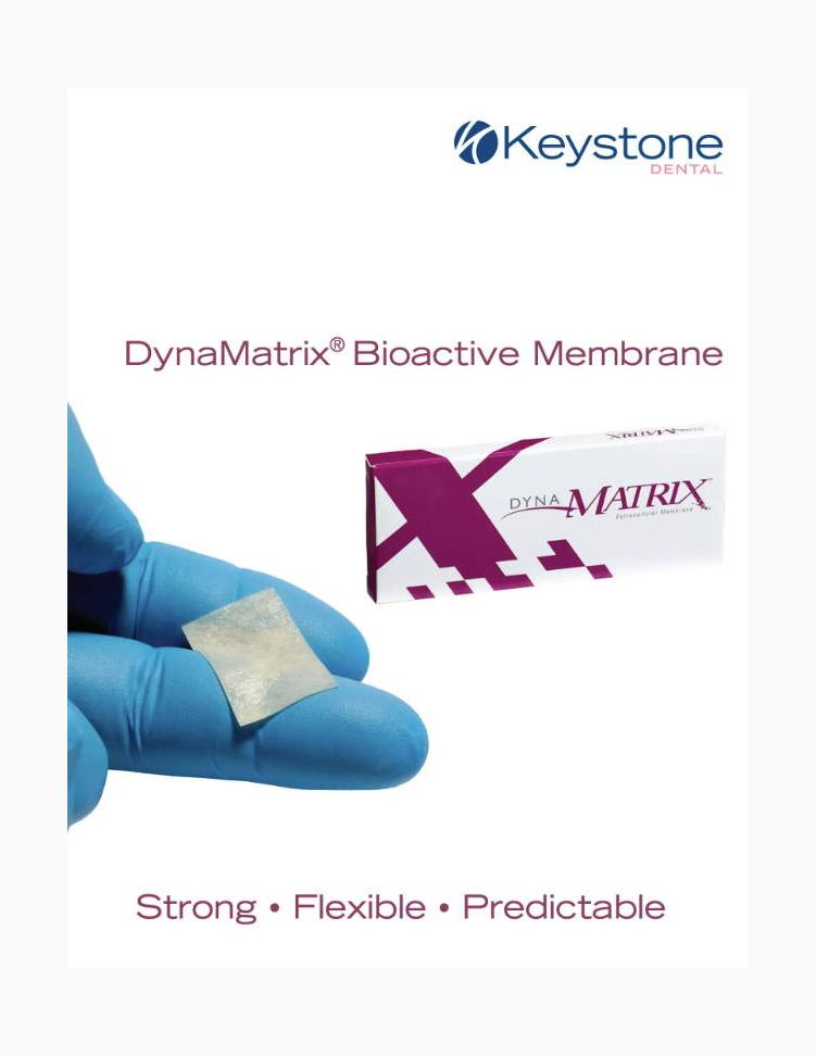 DynaMatrix™ Brochure