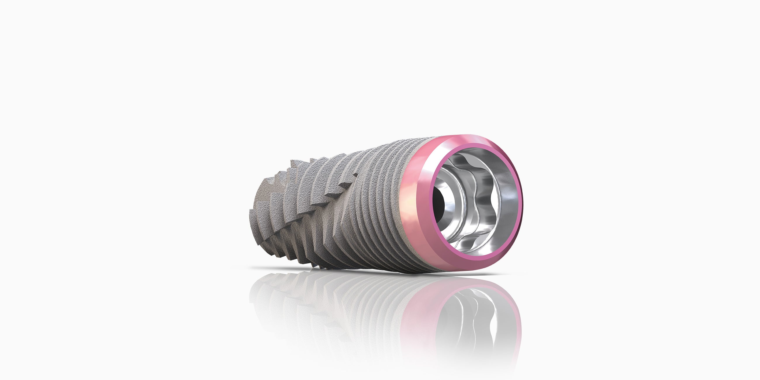 Genesis TiLobe Implant System Keystone Dental Group